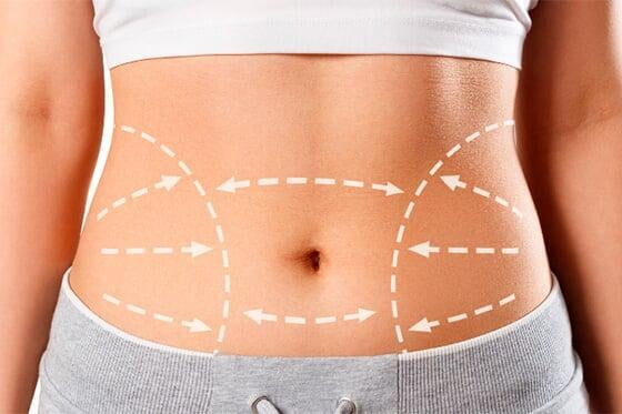 Lipodilucion-Cuenca Con la lipodilución logramos resultados estéticos visibles, seguros y rápidos, ideal para quienes quieren moldear su cuerpo sin cirugía