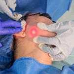 endolift-quito-rostro